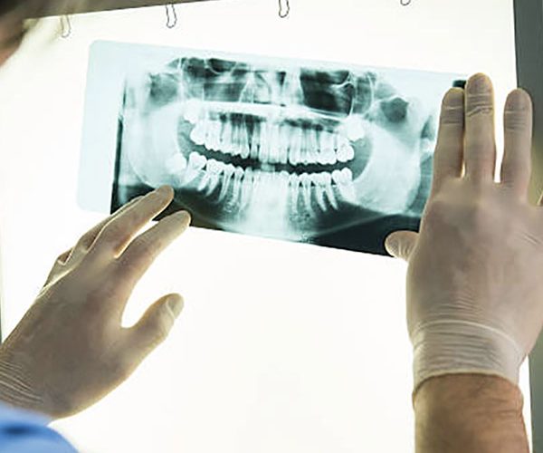 Diagnostica per Immagini - Dentista Santa Mara Capua Vetere