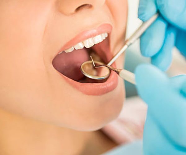 Endodonzia a Santa Maria Capua Vetere